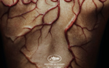 Sanguine