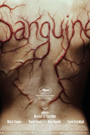 Sanguine